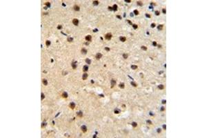 Image no. 1 for anti-FK506 Binding Protein 10, 65 KDa (FKBP10) (AA 65-94), (N-Term) antibody (ABIN453008) (FKBP10 Antikörper  (N-Term))