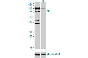 Western blot analysis of ZNF274 over-expressed 293 cell line, cotransfected with ZNF274 Validated Chimera RNAi (Lane 2) or non-transfected control (Lane 1).