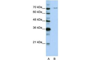 Western Blotting (WB) image for anti-PRP3 Pre-mRNA Processing Factor 3 Homolog (PRPF3) antibody (ABIN2462173)
