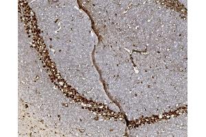 IHC analysis of FOXP1 using anti-FOXP1 antibody (ABIN7602780). (FOXP1 Antikörper  (C-Term))