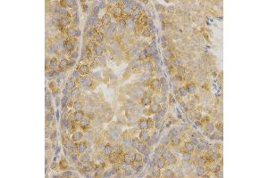 Immunohistochemistry (IHC) image for anti-Oxidized Low Density Lipoprotein (Lectin-Like) Receptor 1 (OLR1) (AA 58-273) antibody (ABIN1681162) (OLR1 Antikörper  (AA 58-273))