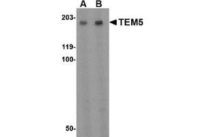 Western blot analysis of TEM5 in rat kidney tissue lysate with this product at (A) 2 µg/ml and (B) 4 μg/ml. (GPR124 Antikörper  (Center))