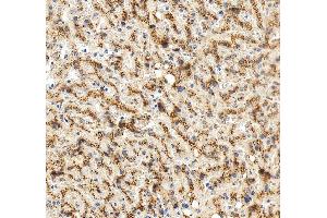 IHC analysis of LIMPII/SCARB2 using anti-LIMPII/SCARB2 antibody (ABIN7601833).