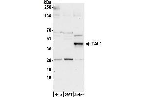 Western Blotting (WB) image for anti-T-Cell Acute Lymphocytic Leukemia 1 (TAL1) (AA 1-50) antibody (ABIN7450800)