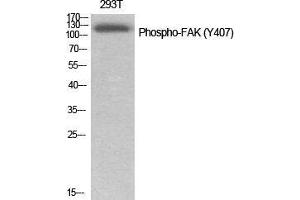 Western Blot (WB) analysis of specific cells using Phospho-FAK (Y407) Polyclonal Antibody. (FAK Antikörper  (pTyr407))