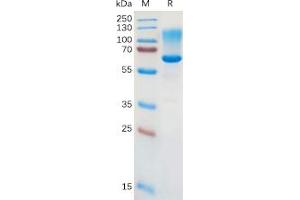 Human CD43 Protein, hFc Tag on SDS-PAGE under reducing condition.