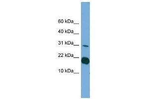 Western Blot showing IL1F5 antibody used at a concentration of 1-2 ug/ml to detect its target protein. (FIL1d Antikörper  (Middle Region))