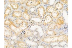 ABIN6262232 and ABIN6266695 at 1/100 staining human normal kidney tissue by IHC-P. (HGS Antikörper  (Internal Region))