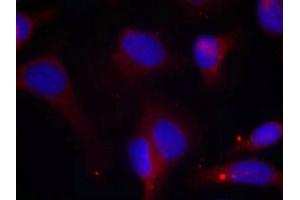 Immunofluorescence staining of methanol-fixed Hela cells using Zap-70(Phospho-Tyr319) Antibody. (ZAP7 (pTyr319) Antikörper)