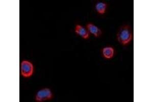 Immunofluorescent analysis of GPR101 staining in HeLa cells.