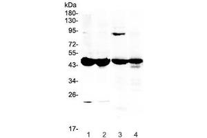 Western blot testing of 1) mouse testis, 2) mouse ovary, 3) rat stomach and 4) rat ovary lysate with Ada antibody at 0. (ADA Antikörper  (AA 2-241))