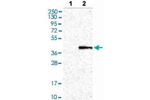 Western blot analysis of Lane 1: Negative control (vector only transfected HEK293T lysate), Lane 2: Over-expression lysate (Co-expressed with a C-terminal myc-DDK tag (~3. (CTSO Antikörper  (AA 71-176))