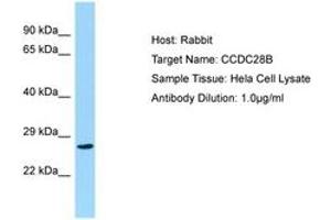 Image no. 1 for anti-Coiled-Coil Domain Containing 28B (CCDC28B) (C-Term) antibody (ABIN6750165) (CCDC28B Antikörper  (C-Term))
