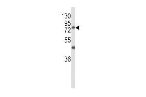 Western blot analysis of GALNT3 Antibody (Center) (ABIN653156 and ABIN2842724) in MCF-7 cell line lysates (35 μg/lane). (GALNT3 Antikörper  (AA 454-481))