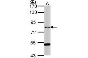 WB Image Sample (30 ug of whole cell lysate) A: Hep G2 , 7. (AGAP1 Antikörper  (C-Term))
