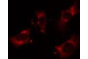 Immunofluorescence (fixed cells) (IF/ICC) image for anti-UDP-Gal:betaGlcNAc beta 1,4- Galactosyltransferase, Polypeptide 3 (B4GALT3) (Internal Region) antibody (ABIN6258613)