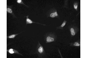 Immunofluorescent staining of HeLa (ATCC CCL-2) cells. (CDK4 Antikörper  (N-Term))