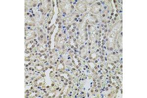 Immunohistochemistry of paraffin-embedded rat kidney using SMARCC2 antibody. (SMARCC2 Antikörper  (AA 150-250))