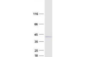 Validation with Western Blot (C11ORF49 Protein (Transcript Variant 3) (Myc-DYKDDDDK Tag))