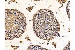 ABIN7096215 and ABIN7100277 at 1/100 staining mouse testis tissue by IHC-P. (PTCD1 Antikörper)