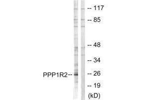Western blot analysis of extracts from Jurkat cells, using PPP1R2 (Ab-120/121) antibody. (PPP1R2 Antikörper  (Ser120, Ser121))