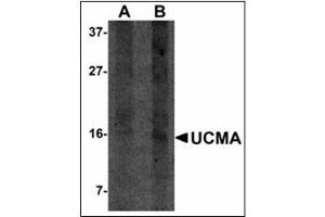 Western blot analysis of UCMA in SW1353 cell lysate with UCMA antibody at (A) 2. (UCMA Antikörper  (C-Term))