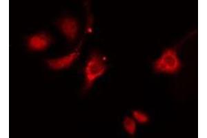 ABIN6276317 staining  HeLa cells by IF/ICC.