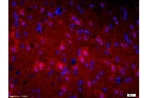 Formalin-fixed and paraffin-embedded rat brain labeled with Mouse Anti-Alpha-Synuclein Polyclonal Antibody, Unconjugatedused at 1:200 dilution for 40 minutes at 37°C. (Alpha, beta Synuclein (AA 122-140) Antikörper)