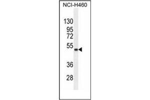 Western blot analysis of FNDC8 Antibody (Center) in NCI-H460 cell line lysates (35ug/lane). (FNDC8 Antikörper  (Middle Region))