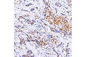 IHC analysis of Rab4/RAB4A using anti-Rab4/RAB4A antibody (ABIN7599733).