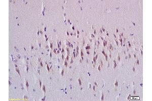 Formalin-fixed and paraffin embedded rat brain tissue labeled with Anti-Rab24 Polyclonal Antibody, Unconjugated (ABIN750373) at 1:200 followed by conjugation to the secondary antibody and DAB staining (RAB24 Antikörper  (AA 1-100))