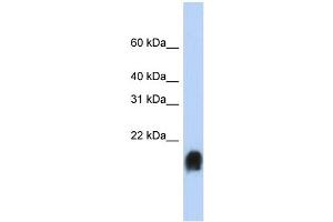 WB Suggested Anti-MUC1 Antibody Titration:  0. (MUC1 Antikörper  (Middle Region))