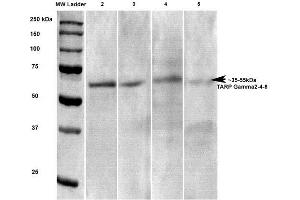 Western Blot analysis of Rat brain lysates showing detection of Stargazin Calcium Channel protein using Mouse Anti-Stargazin Calcium Channel Monoclonal Antibody, Clone S245-36 . (Stargazin Antikörper  (AA 203-323) (FITC))