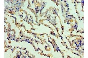 Immunohistochemistry of paraffin-embedded human lung tissue using ABIN7155522 at dilution of 1:100 (SMYD1 Antikörper  (AA 1-350))