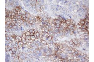 Image no. 1 for anti-Melanoma Antigen Family B, 18 (MAGEB18) antibody (ABIN1499274) (MAGEB18 Antikörper)