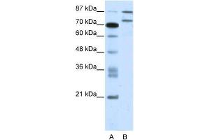 Human Jurkat; WB Suggested Anti-ZNF709 Antibody Titration: 2. (ZNF709 Antikörper  (N-Term))