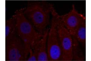 Image no. 1 for anti-Synuclein, alpha (SNCA) (pTyr133) antibody (ABIN401574) (SNCA Antikörper  (pTyr133))