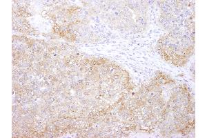 Immunohistochemistry (IHC) image for anti-Eukaryotic Elongation Factor-2 Kinase (EEF2K) (AA 675-725) antibody (ABIN7448957) (EEF2K Antikörper  (AA 675-725))