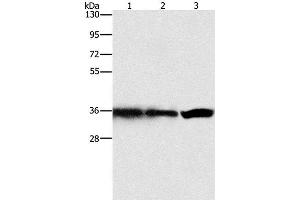 Western Blot analysis of Hela, 293T and 231 cell using GNB1 Polyclonal Antibody at dilution of 1:450 (GNB1 Antikörper)