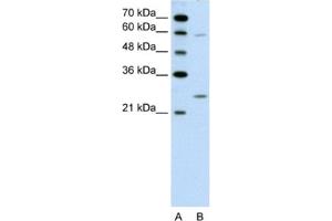 Western Blotting (WB) image for anti-Guanidinoacetate N-Methyltransferase (GAMT) antibody (ABIN2462453)