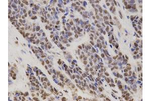 Immunohistochemistry (IHC) image for anti-Hepatoma-Derived Growth Factor (HDGF) antibody (ABIN1876535) (HDGF Antikörper)