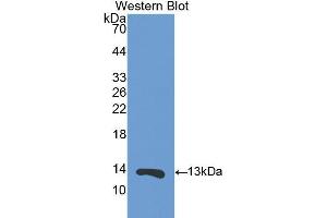 Western Blotting (WB) image for anti-S100 Calcium Binding Protein A11 (S100A11) (AA 1-102) antibody (ABIN1860480) (S100A11 Antikörper  (AA 1-102))