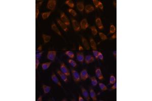 Immunofluorescence analysis of L929 cells using SEC61B antibody (ABIN7270173) at dilution of 1:100.