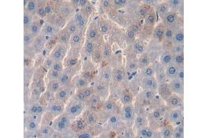 Used in DAB staining on fromalin fixed paraffin- embedded liver tissue (AADAT Antikörper  (AA 99-425))