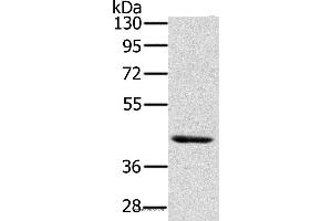 Western blot analysis of Skov3 cell, using HSD3B7 Polyclonal Antibody at dilution of 1:400 (HSD3B7 Antikörper)