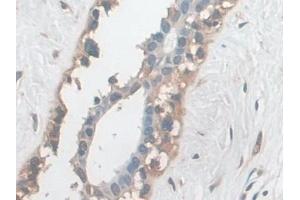 Immunohistochemistry (IHC) image for anti-Ezrin (EZR) (AA 1-295) antibody (ABIN7440074)