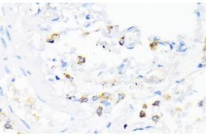 Immunohistochemistry of paraffin-embedded Human lung using CAMP Polyclonal Antibody at dilution of 1:200 (40x lens). (Cathelicidin Antikörper)