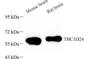 Western blot analysis of TBC1D24 (ABIN7075847) at dilution of 1: 1000 (TBC1D24 Antikörper)