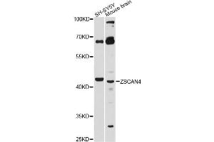 Western blot analysis of extracts of various cell lines, using ZSCAN4 antibody. (ZSCAN4 Antikörper)