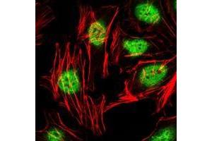 Immunofluorescence analysis of Hela cells using ZBTB16 antibody (green). (ZBTB16 Antikörper)